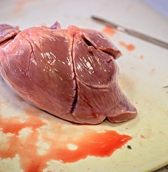 Anatomie srdce v praxi